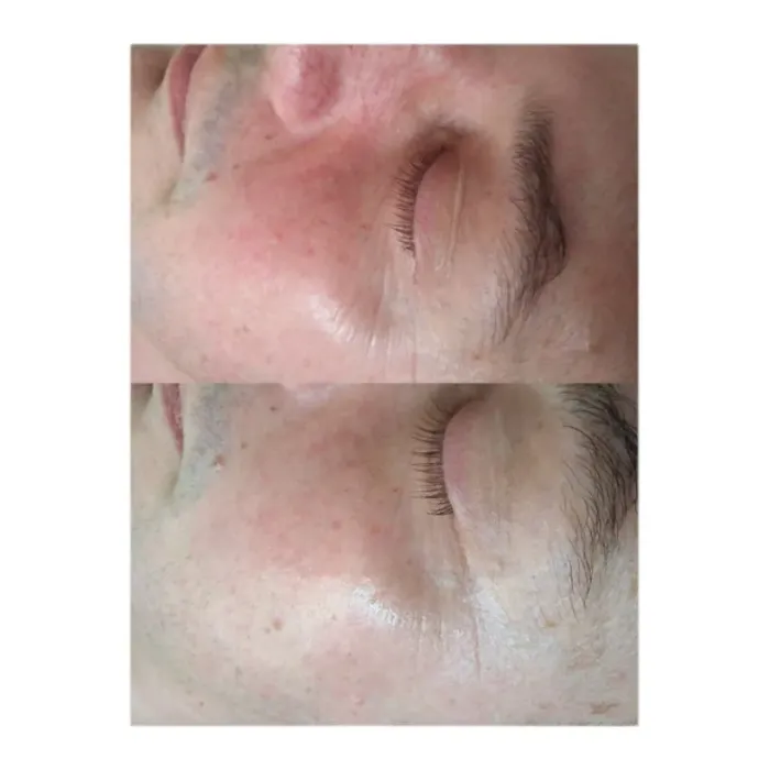 Сыворотка обновляющая с фитиновой кислотой Alphascience Phytic [TC] Serum